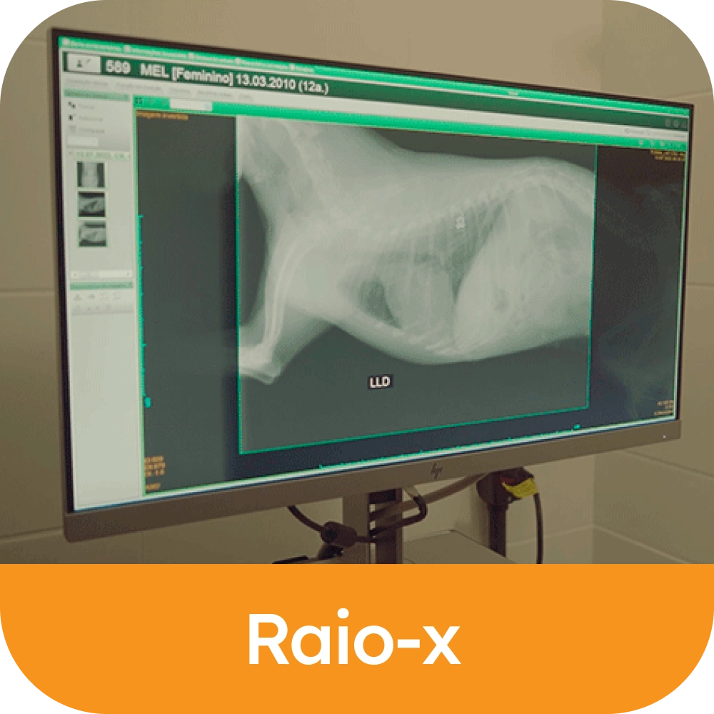 Raio-X